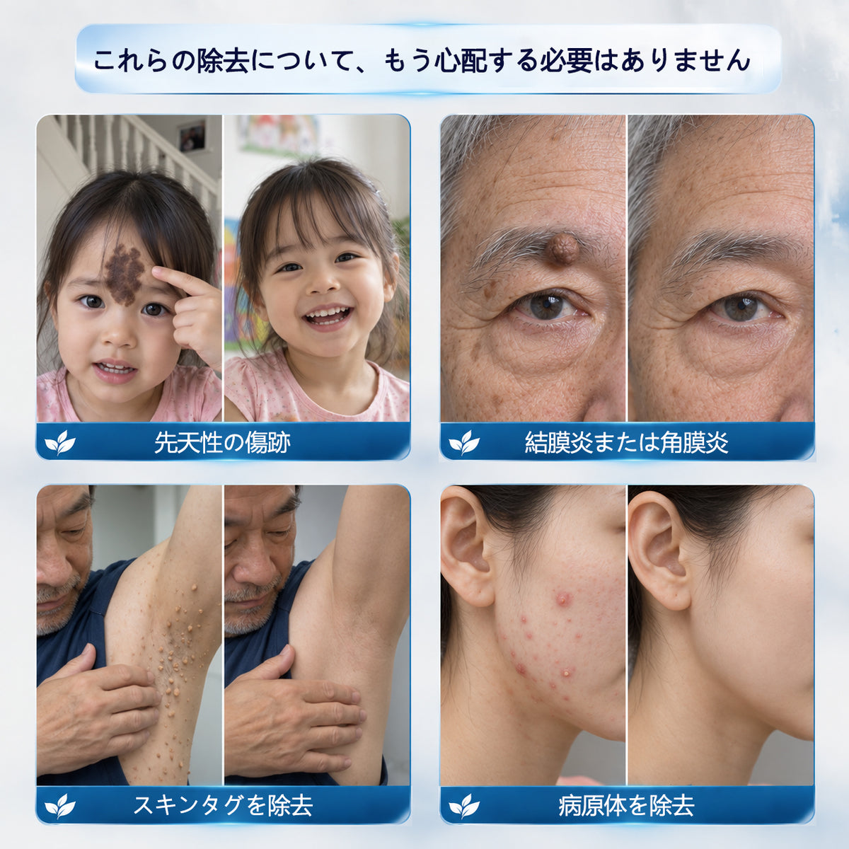 CleraNaure® 肌凹凸リファインクリーム｜気になる肌の盛り上がり・ほくろ・シミにアプローチ 刺激の少ない自宅スキンケアクリーム