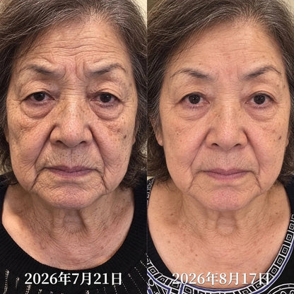 CleraNaure® 🏆 𝐏𝐃𝐑𝐍 エイジングケア スポット美容スティック｜乾燥による小ジワ・ハリ不足・気になるスポットを集中ケア✨