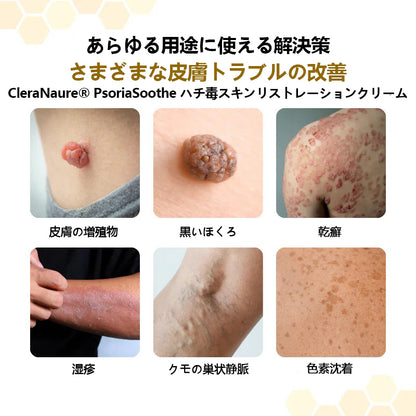 🐝CleraNature® PsoriaSoothe 蜂毒配合スキンリジェネレーティングクリーム