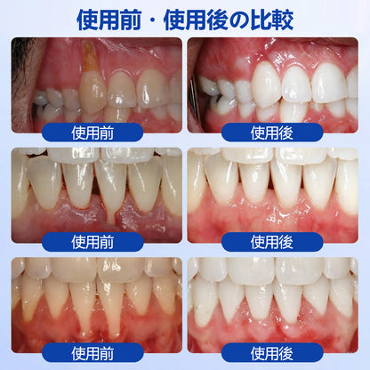 CleraNaure® GumRevive 歯周組織修復ジェル