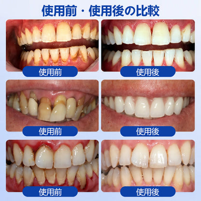 CleraNaure® GumRevive 歯周組織修復ジェル