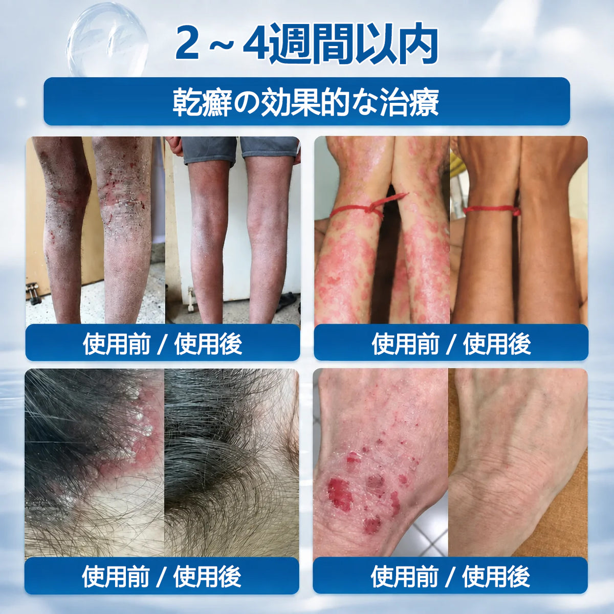 CleraNaure® 肌凹凸リファインクリーム｜気になる肌の盛り上がり・ほくろ・シミにアプローチ 刺激の少ない自宅スキンケアクリーム