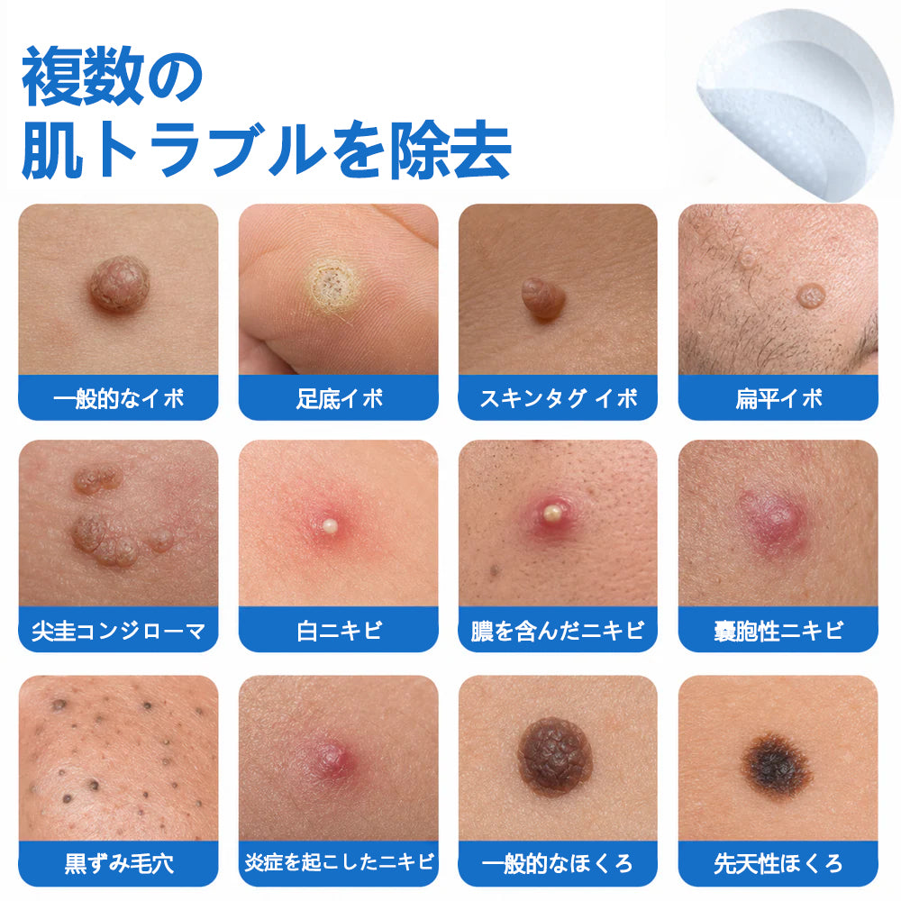 🔥ClearaNature® 2in1 マイクロニードルハイドロコロイドパッチ イボ・ほくろ・ニキビケア シワ・傷跡・肌荒れ改善 顔＆全身用目立たないケアパッチ