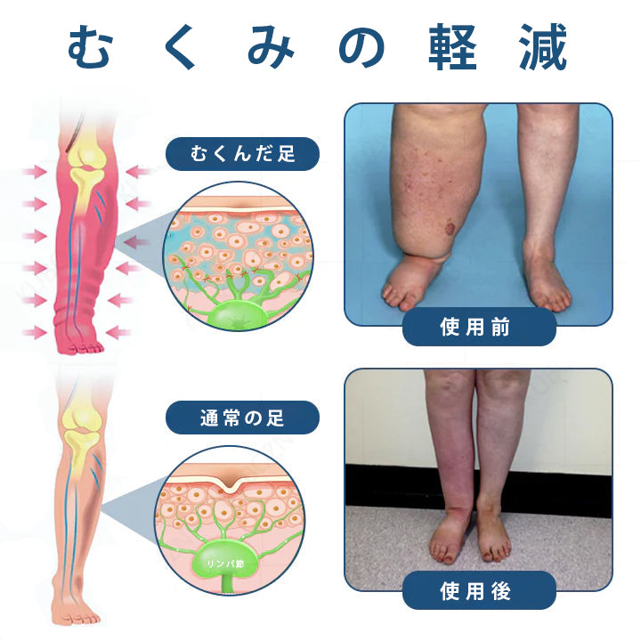 CleraNature® リンパドレナージと腫れの緩和のためのロールオン ポンプ クリーム