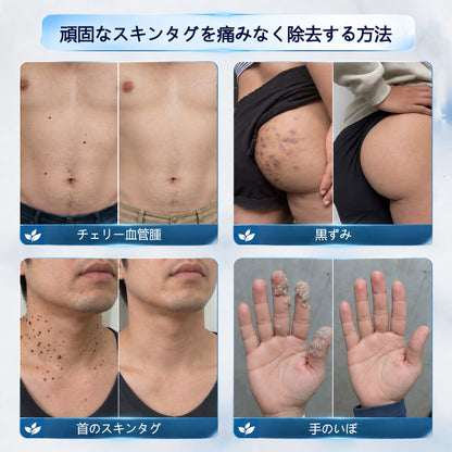 CleraNaure® 肌凹凸リファインクリーム｜気になる肌の盛り上がり・ほくろ・シミにアプローチ 刺激の少ない自宅スキンケアクリーム