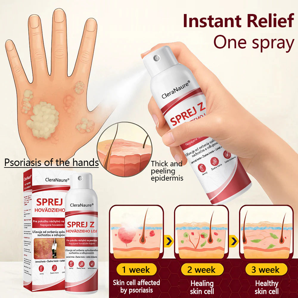 CleraNature® Beef Tallow Spray na svrbiacu, olupujúcu pokožku pri psoriáze