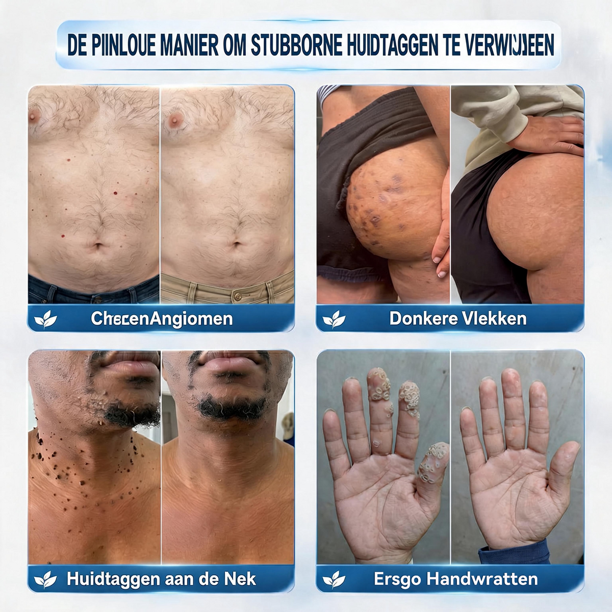 CleraNaure® 肌凹凸リファインクリーム｜気になる肌の盛り上がり・ほくろ・シミにアプローチ 刺激の少ない自宅スキンケアクリーム