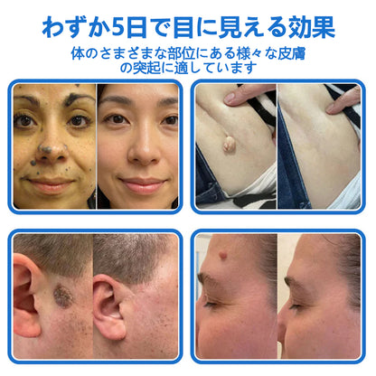 🔥ClearaNature® 2in1 マイクロニードルハイドロコロイドパッチ イボ・ほくろ・ニキビケア シワ・傷跡・肌荒れ改善 顔＆全身用目立たないケアパッチ