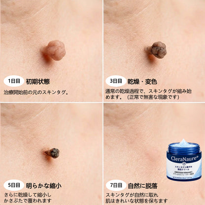 CleraNaure® 肌凹凸リファインクリーム｜気になる肌の盛り上がり・ほくろ・シミにアプローチ 刺激の少ない自宅スキンケアクリーム
