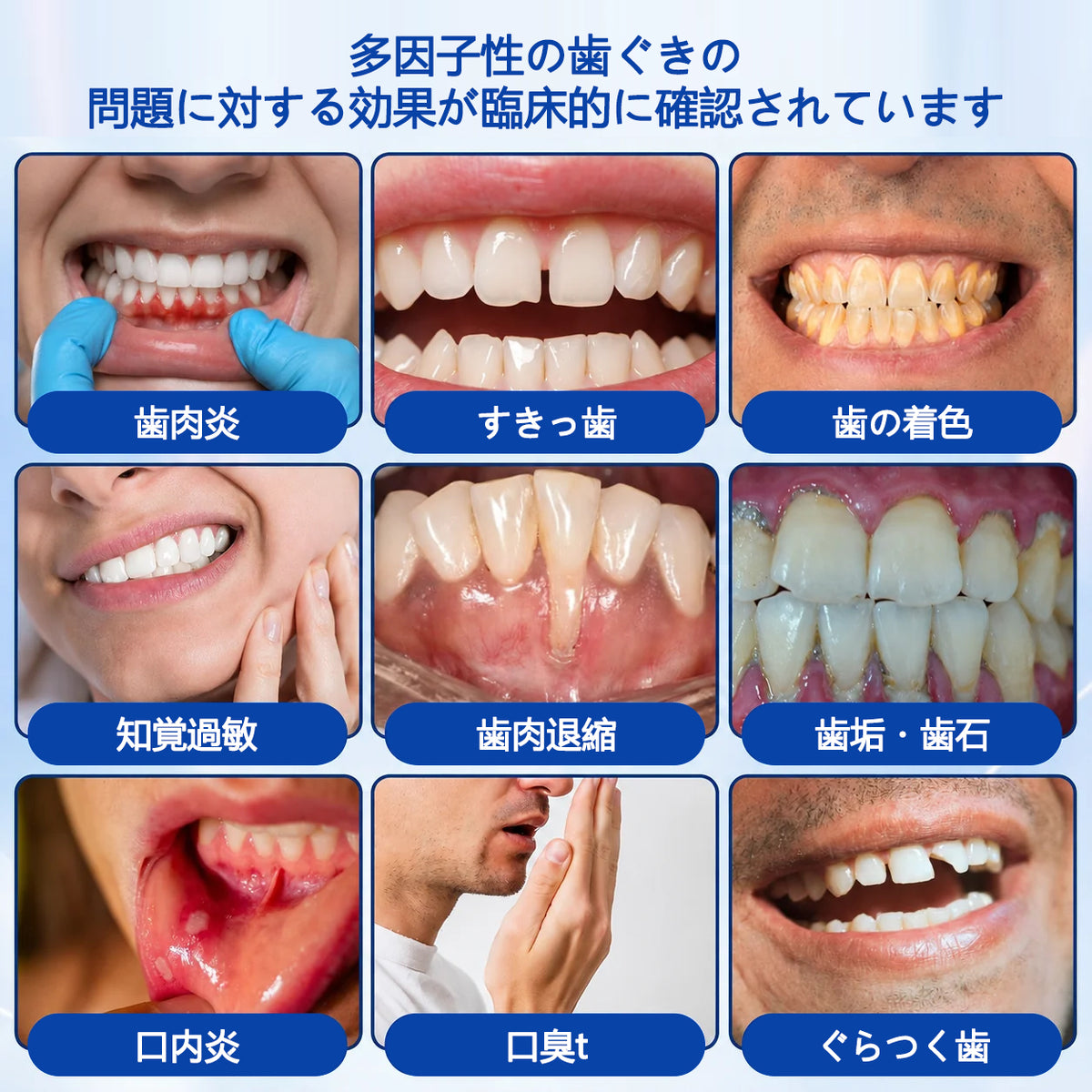 CleraNaure® GumRevive 歯周組織修復ジェル