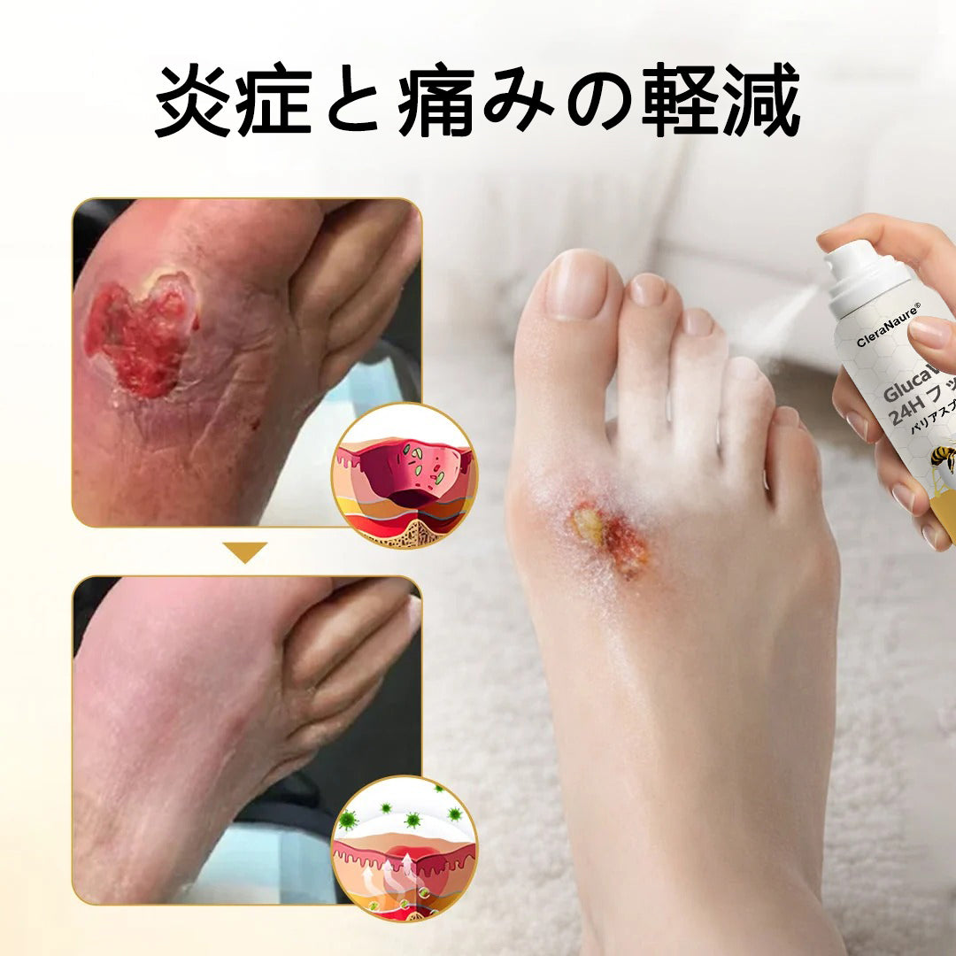 CleraNaure® GlucaVeil 24 時間フットケア スプレー