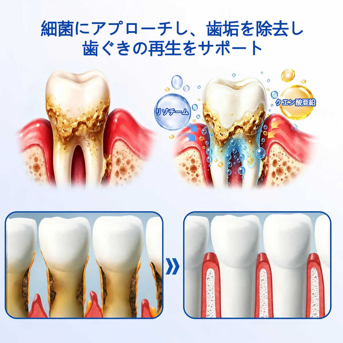 CleraNaure® GumRevive 歯周組織修復ジェル