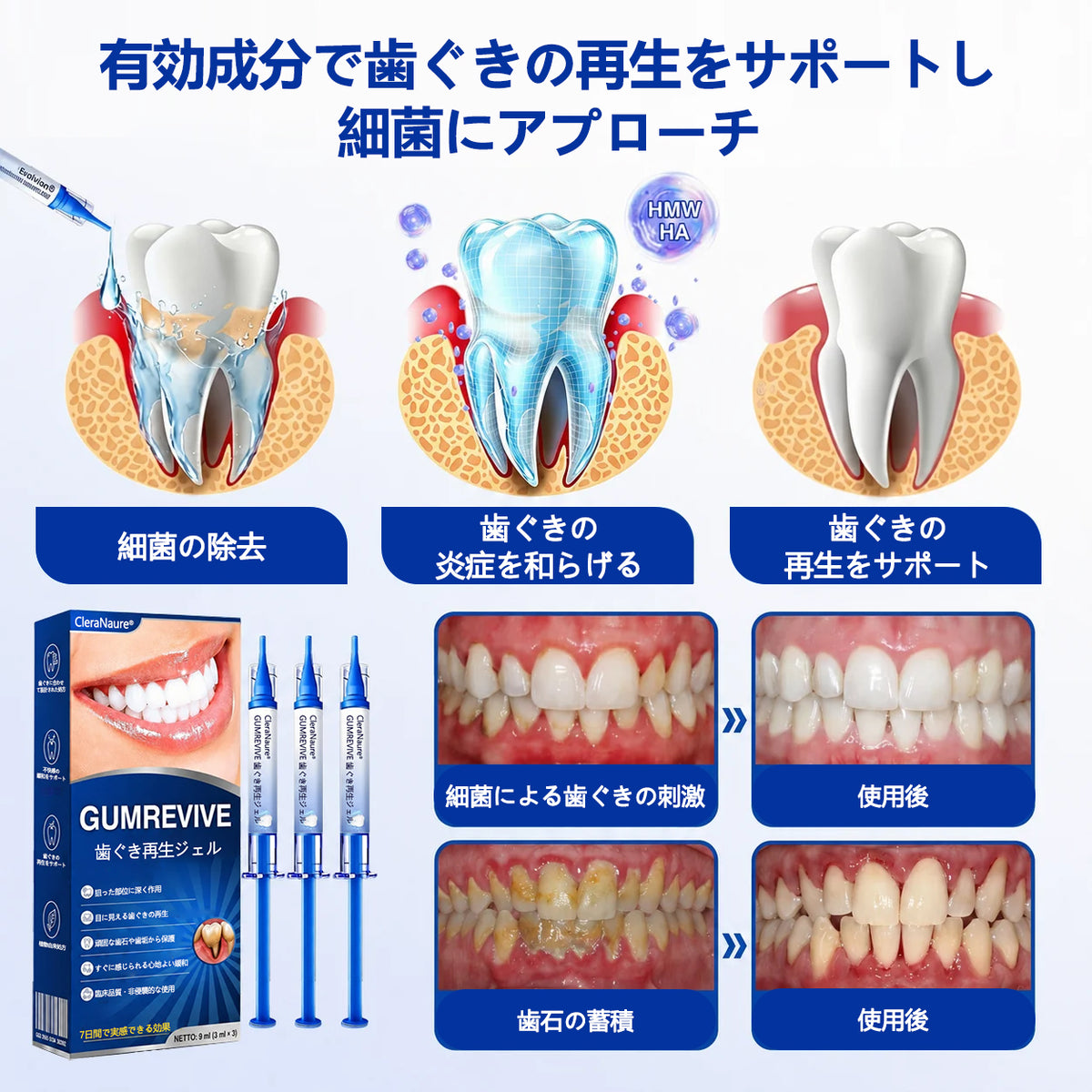 CleraNaure® GumRevive 歯周組織修復ジェル