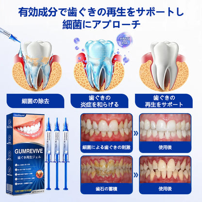 CleraNaure® GumRevive 歯周組織修復ジェル